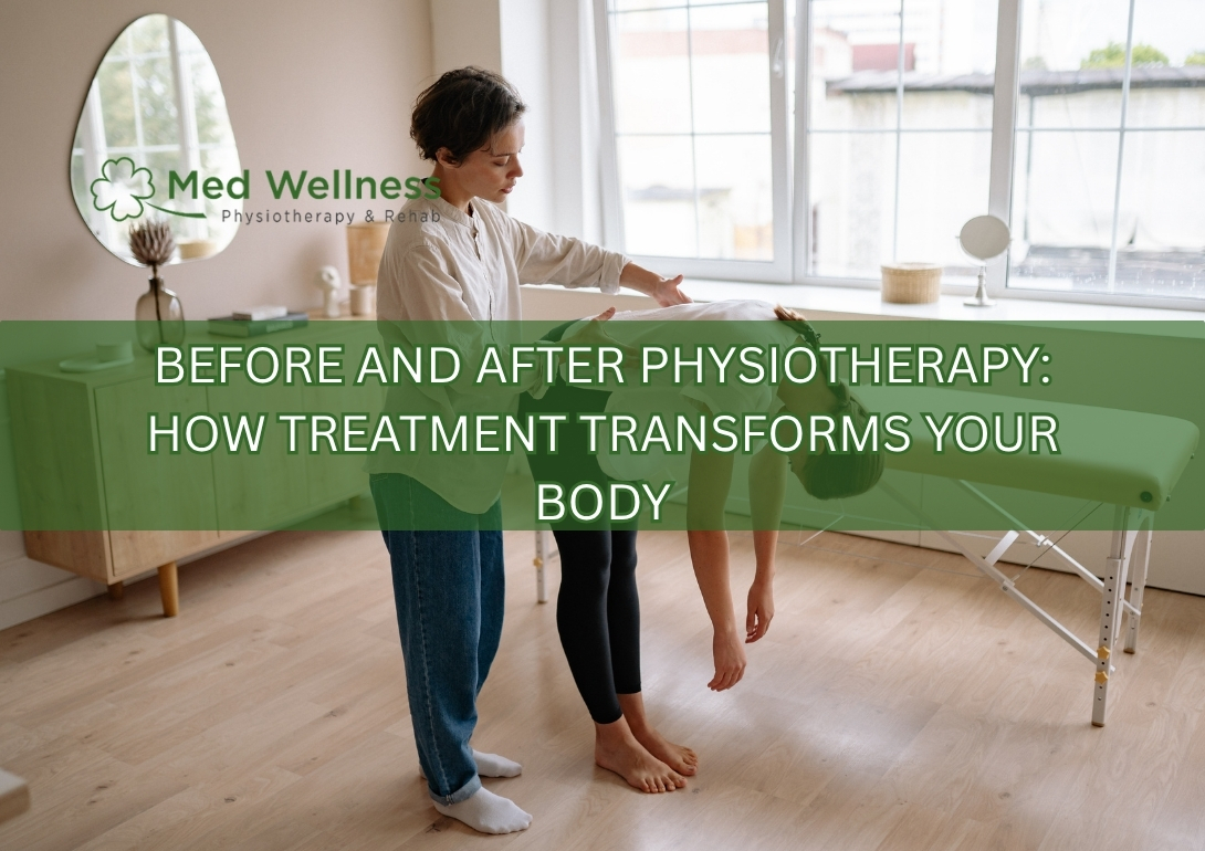 Before and after physiotherapy showing recovery mobility and pain relief transformation