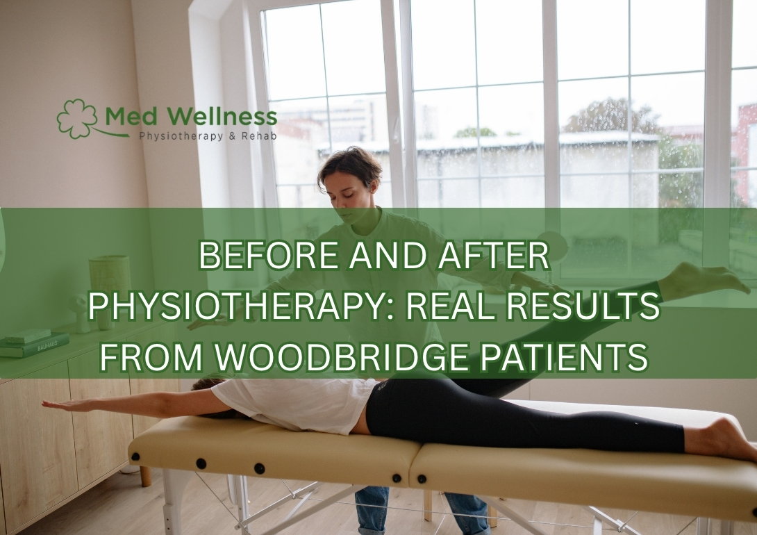 physiotherapy results Woodbridge before after