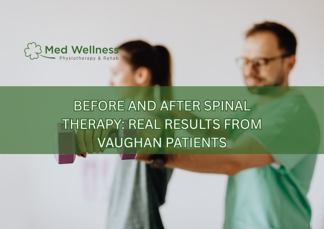 spinal therapy before and after Woodbridge