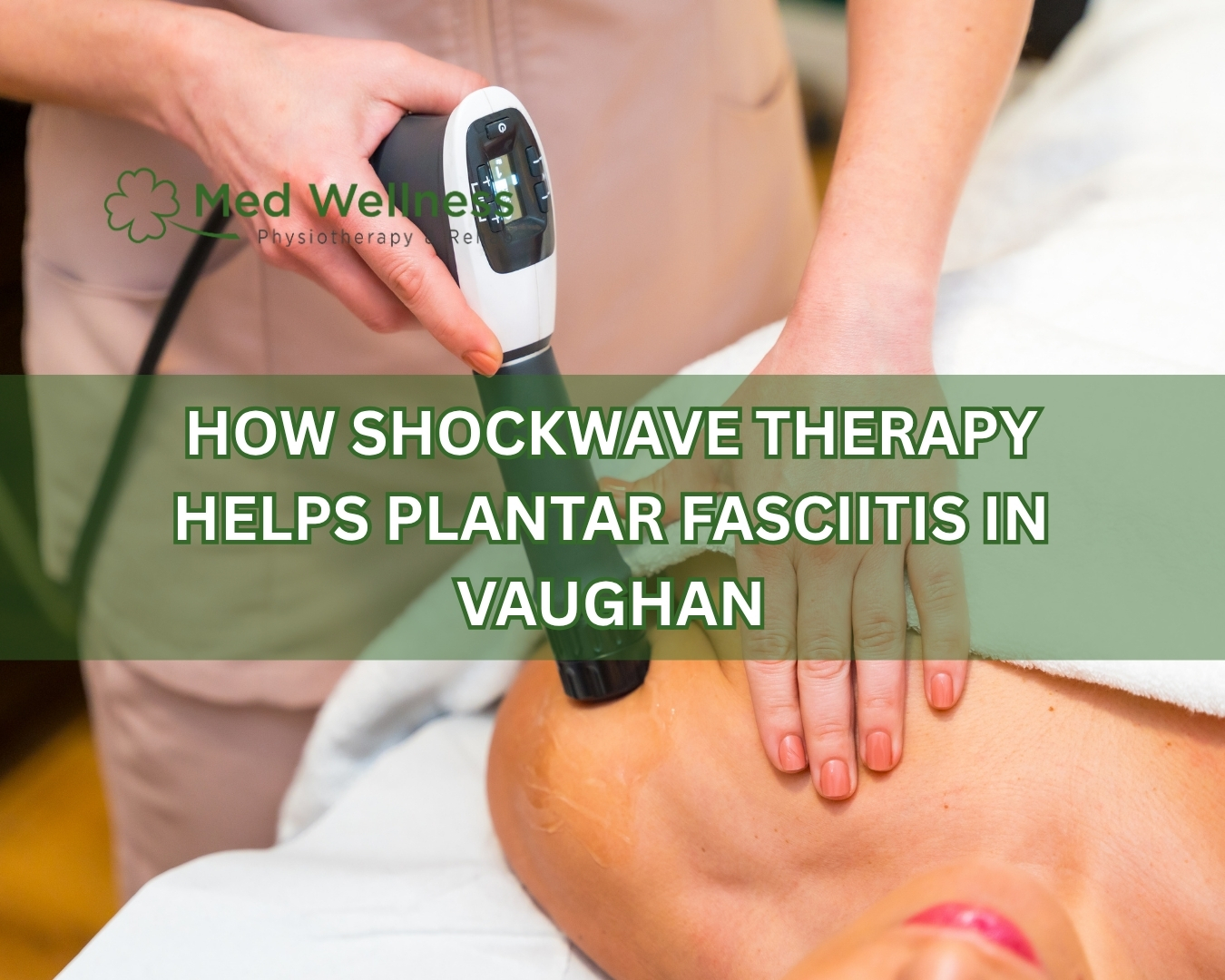 How Shockwave Therapy Helps Plantar Fasciitis in Vaughan